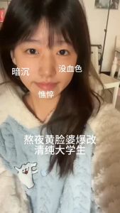 Astragalus Cream 55g Moisturizing Fades Yellow Spots Brighten Skin Tone Hydrating Face Cream