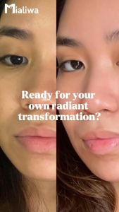 Belo Nutraceuticals Glutathione + Collagen: A Comprehensive Guide