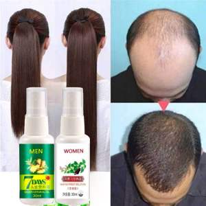 SPRAY HAIR TREATMENT MEN WOMEN pelebat rambut merawat rambut gugur tumbuhkan rambut