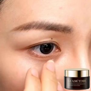 Whitening eye cream Anti dark circles under the eyes 30g Fade fine lines Moisture Nourishing the skin Anti aging Quick removal Crema Para Ojeras Oscuras Best Cream To Tighten Neck - Lazada