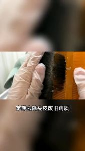 Lược bí chải chấy bằng gỗ bằng nhựa cao cấp lược dầy lược dày chải đầu lược chải chấy -JOYYY