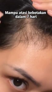 BPOM Red Ginseng Hair Tonic 250ML by Yurizumi Tonik Rambut - Treatment - Haircare Anti Rontok Memperkuat Akar Rambut