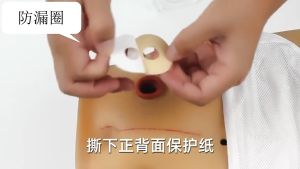 10pcs colostomy bag leak-proof ring ointment stoma ring stoma care protection skin stoma ring bottom plate