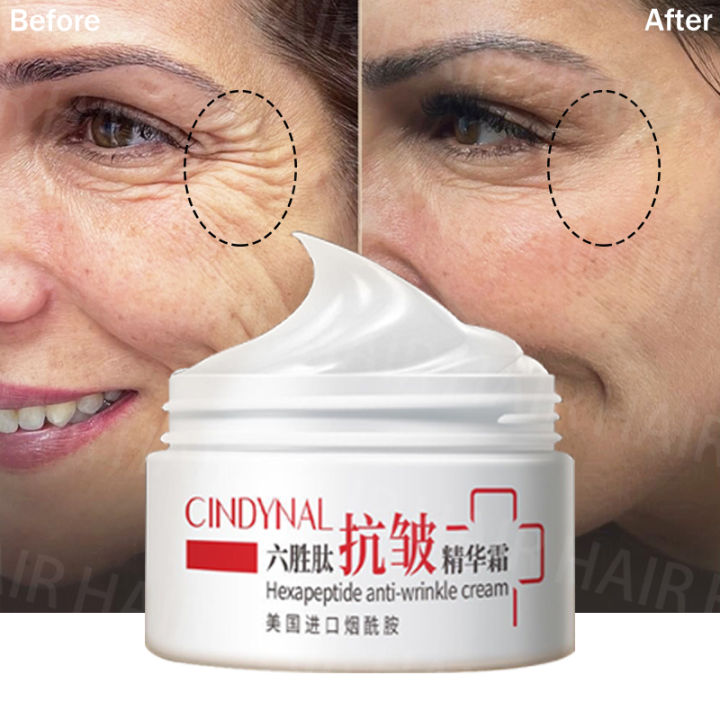 Hexapeptide Anti Wrinkle Cream Anti wrinkle Serum Lifting Anti Aging Lighten Dark Spots Remove Wrinkles Moisturizer Treatment Facial neck Cream Lazada PH