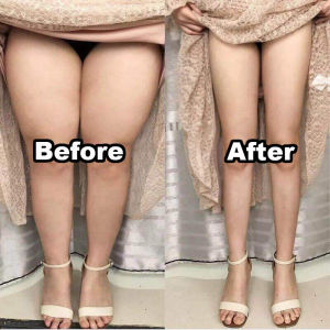 slim leg thigh slimming patch fat burner kecilkan peha  herbal kuruskan badan dengan cepat bakar lemak 30pcs/box