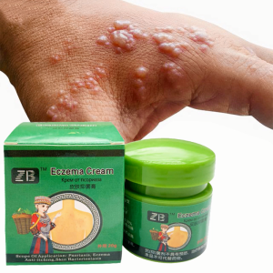 zb Eczematoid Eczema Ointment Psoriasis Cream Skin Care Cream Dermatitis  Treatment 20g