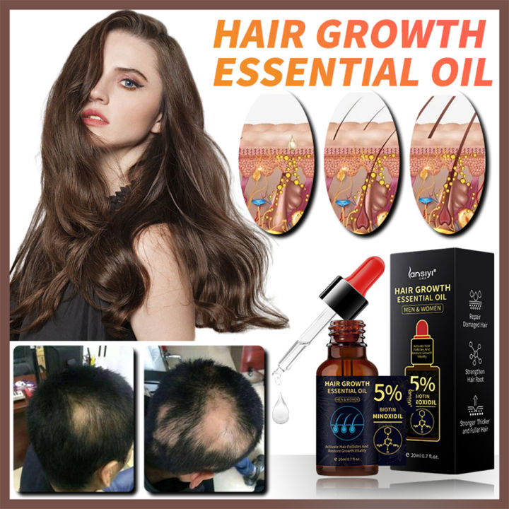 Hair Growth Essence Oil 20ml Ginger Hair Serum Thicken Anti Hair Loss ...