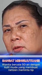 FREE SHIPPING | Qinglin Wrinkle Removal Cream Original Firming Anti-Wrinkle Cream Dilute Fine Lines Repair Skin Care