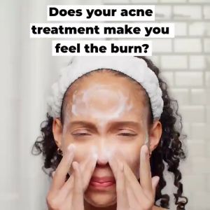 Stridex Acne Treatment 2% Salicylic Acid Pads / 0.5% Salicylic Acid Gentle Acne Removal and Oil Control 55pcs/box