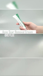 【Local Stock】BREYLEE Treatment Remove Scar Removal Cream Stretch Marks Remove Cream 30g