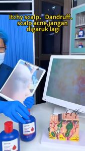 NIPPORI Selenium Disulfide Haircare Shampo: Mengontrol Minyak & Mengurangi Ketombe