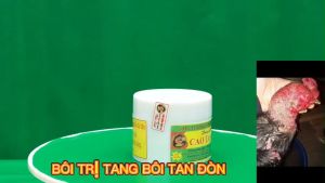 Cao tan đòn trúc linh tan máu bầm liền da phục hồi nhanh