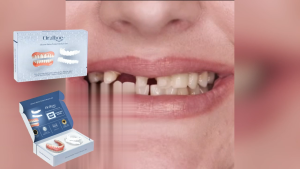 【Ready Stock】EELHOE Silicone Denture Reline Kit – Comfort Fit False Teeth Cushion Flexible Denture Liner for Secure Grip Reusable Denture Care Accessory