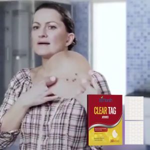 Ximonth  Penghilang Tahi Lalat Efek penghilangan tahi lalat yang baik cocok untuk semua jenis kulit