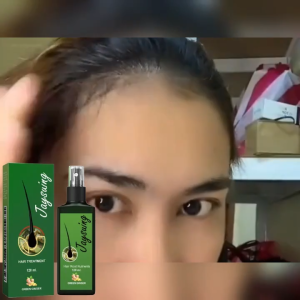 【Beli 1 Dapatkan 1】Jaysuing Ginger Spray Penumbuh Rambut - Anti Rontok & Perawatan Kebotakan untuk Pria & Wanita - Hair Growth Serum 120ml
