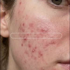🌙 [SOME BY MI] AHA-BHA-PHA Miracle Toner / Exfoliating / Skin Shoothing / Pore Care 150mlx3