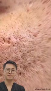 【ซื้อ 1 แถม 1】 รอยแผลเป็น Remover สําหรับเก่าขาเจลแบรนด์เดิมสิวครีม Fade ใหม่ Burns และ Scaldings ไม่มี Leaving รอยแ30g ครีมทาแผลเป็น ลบรอยแผลเปน ลดรอยเเผลเป็น ​เหมาะสำหรับผิวรอยแตกลาย น้ำร้อนลวก แผลผ่าตัด ยาแก้ขาลาย ครีมลดรอยแผลดำ ครีมลดรอยแผลเป็น scar g