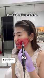 (COD) Solcare Collagen Pore Minimizer Serum - Cream Pengecil Pori dan Bopeng