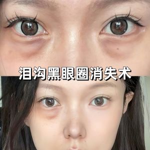 Powerful Three-Color Concealer Cream High Brightening Liquid Cover Dark Circles Spot Treatment Moisturizing for All Skin Types