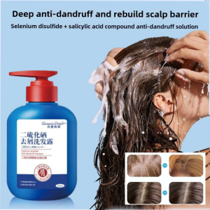 Selenium Sulfide Anti-Dandruff & Anti-Itch Shampoo Deep Mite Removal Oil Control Reduces Scalp Irritation Scalp Care Shampoo