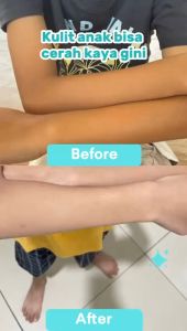 Skin Serum Lotion Mencerahkan Kulit Bayi dan Anak