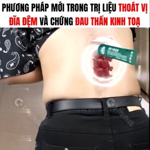 Cold Compress Gel Giảm đau thắt lưng với khả năng thẩm thấu từng lớp (Xanh/Đỏ)