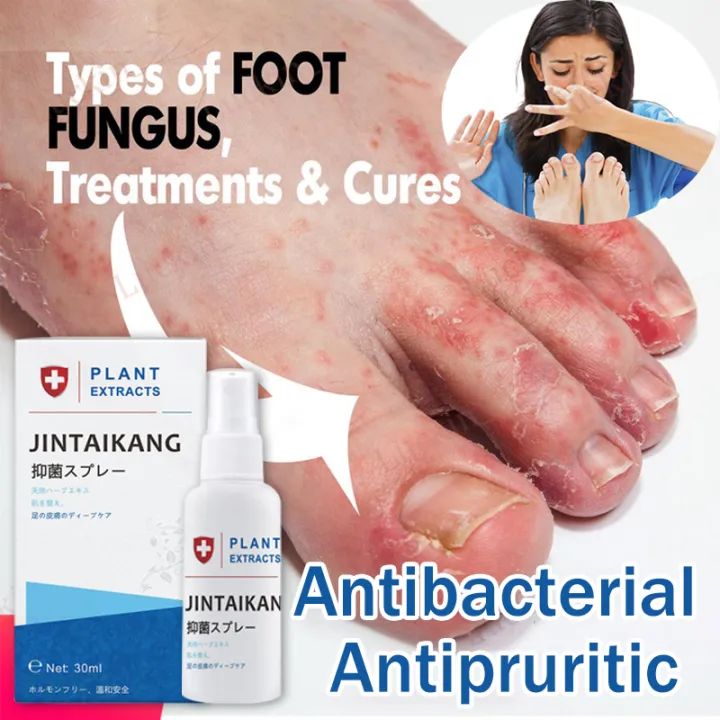 Herbal Foot Spray Antifungal Athlete's Foot Jock Itch Spray treatment ...