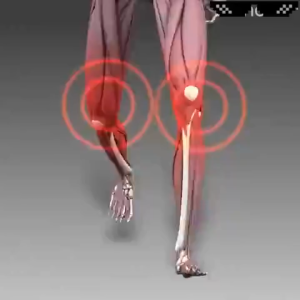 Bee Venom joint Pain relief cream joint and bone Treatment Gel supplement treat joint knee pain toe bone pain relief of joint pain professional treatment knee shoulder Neck lumbar