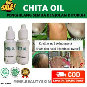 Benjolan 7 Hari Langsung Hilang!! CHITA OIL Penghilang Benjolan Dan Gatal Gatal 100% Original | Obat Penghilang Benjolan | Obat Lipoma | Obat Tiroid | Obat Penghilang Kista | Penghilang Uci - Uci | Minyak Oles Benjolan Oil Benjolan DLL