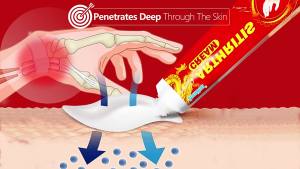 LZD Sumifun 20g Tendon Sheath Cream   Mouse Hand Thumb Wrist Wristband Care Cream  K10019