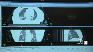 เซซามิน Aimmura-X สูตรเข้มข้น