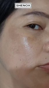 CREAM FLEK UV SHENOX: Solusi Penghilang Flek Hitam & Melasma