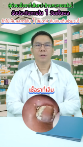 💥ขวดเดียวก็รักษาโรคเชื้อราที่เล็บได้💥น้ำยารักษาโรคเชื้อราที่เล็บ/น้ำยารักษาเชื้อราที่เล็บ/ เอสเซ้นส์ซ่อมแซมเล็บ