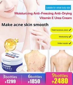 Vitamin E Urea Cream fall and winter moisturizing moisturizing cream to chicken skin anti-dry cracking moisturizing fruit acid moisturizing hydration nourishing natural vitamins