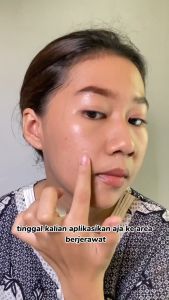 YURIZUMI Obat Jerawat Paling Ampuh Cewek / Acne Removal Cream Acne Treatment Spots Oil Control 20 GR
