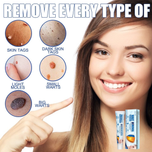 Wart Remover Ointment Ointment 20g