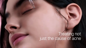 COSRX The Niacinamide 15 Serum 15% High Concentration Niacinamide Oil Control Minimize Pores Fade Post Acne Marks Even Skin Tone Serum With Zinc PCA & Acetyl Glucosamine For Oily Acne Prone Skin