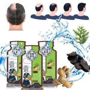 HÀNG N- KHẨU -1 HỘP 10 GÓI Dầu Gội Thảo Dược Mọc Tóc Gừng Jurong - Jurong Chống Gãy Rụng Tóc Đen Tóc Chống Gàu Ngứa Nấm