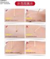 肤质点痣的药膏 点痣防疤+修复剂Ointment for moles on the skin Anti-scar + repairing agent for moles. 