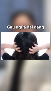 Dầu Gội Selsun chống gàu sạch gàu và hết ngứa da đầu Selsun Anti-Dandruff Shampoo