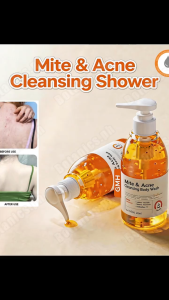 BUY 1 TAKE 3 Acne-Fighting Cleansing Body Wash 250ml Antibacterial Whitening Moisturizing Oil Control Refreshing And Comfortable Deep Cleanses Reduces Mites Soothes Skin Irritation Suitable For All Skin Types