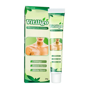 Eelhoe Vitiligo Therapeutic Cream Portable Safe Vitiligo Treatment Leukoplakia Care Cream Pigmentation Regulating Moisturizers Skin Health Care 20g