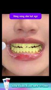 Kem Đánh Răng YAYASHI 120g – Trắng Răng Giảm Ê Buốt Hết Hôi Miệng – Làm Sạch Mảng Bám Hiệu Quả