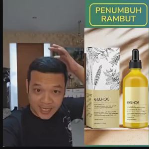 Eelhoe Minyak Esensial Rambut Tebal Rosemary Esensi Perbaikan Minyak Rambut Bergizi Esensi 60Ml Minyak Esensial Rambut Tebal Rambut Penumbuh Rambut Botak Penebal Rambut Penumbuh Rambut Cepat Anti Rontok Rambut Pria Dan Wanita