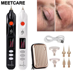 Electric Plasma Pen: A Comprehensive Guide to Facial Wart & Dark Spot Removal
