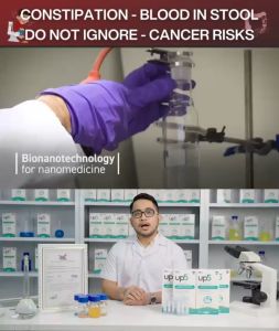 [ LEGIT & NEW ] Up5 Nano Probiotics for Colitis Hemorrhoids Constipation and Diarrhea contains 5 billion probiotic spores Nanotechnology in the USA (20 tubes x 10ml)
