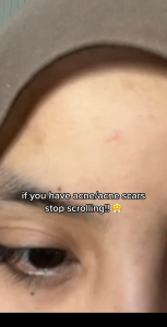 [SET 3] SKINTIFIC Clay Mask Stick kit - Mugwort Acne Facial Alaska Volcano Blackhead Remover Mud Mask Muka Niacinamide Bright