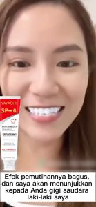 Pasta Gigi Pemutih Probiotik 120ML Sp-6 Pembersih Karang Gigi Memutihkan Gigi Kuning Penghilang Karang Gigi Dan Pemutih Gigi