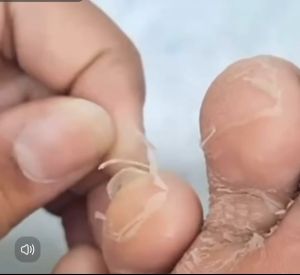 มาร์คเท้า Foot Peeling Double Essence Mask 40g ✨No.1 จาก Olive Young จากเกาหลี แท้ 100%