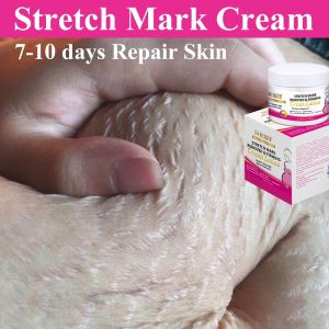 stretch mark cream for pregnancy anti stretch mark cream 150g Remove Stretch Marks gentle ​and fade postpartum stretch marks 妊娠纹修复
